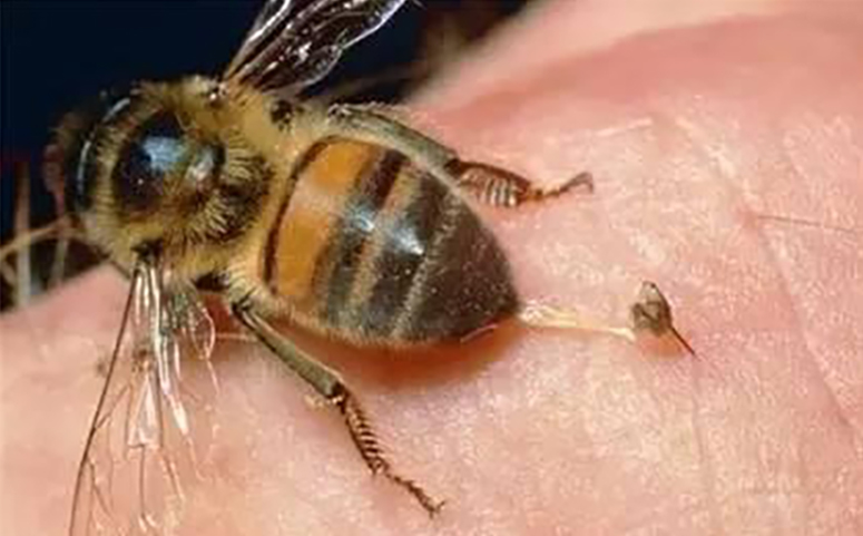 被蜜蜂蛰图片